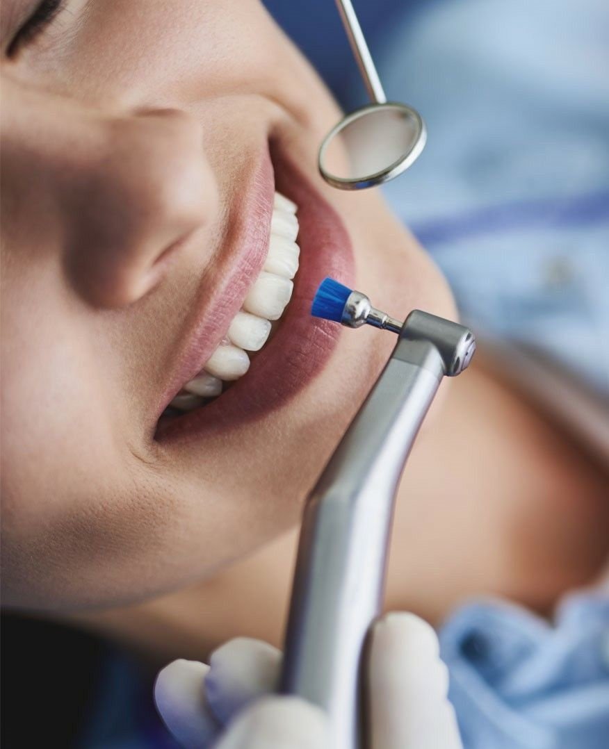 Procedimento de limpeza e avaliação odontológica